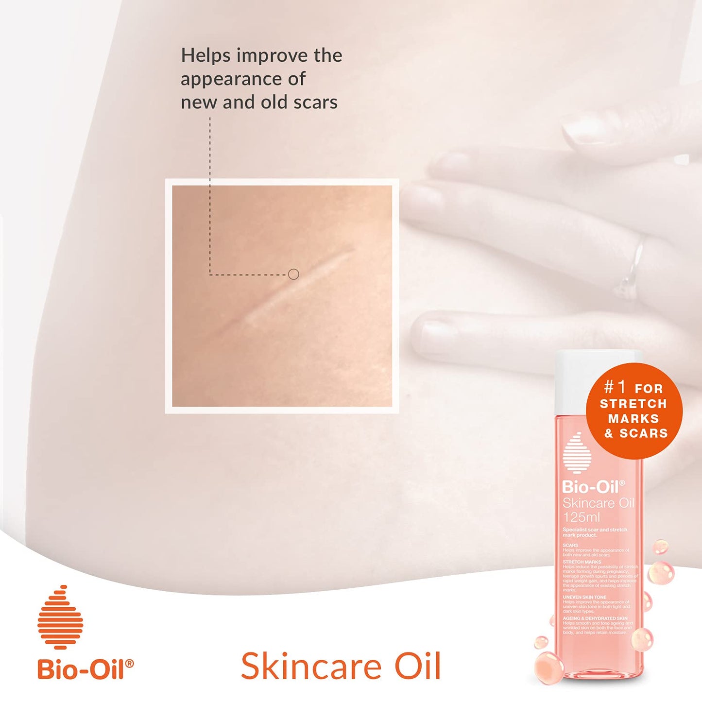 Bio-Oil Skincare Oil - Improve the Appearance of Scars, Stretch Marks and Skin Tone - 1 x 200 ml